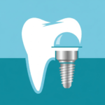 Dental implant treatment visual
